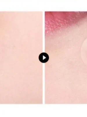 VT COSMETICS Náplasti na akné Pro Cica Centella Asiatica Tiger Clear Spot Patch (66 ks) Nakupujte Hned